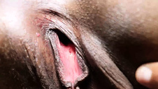 laskeczka i jej kolega ze złamaną ręką