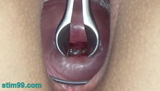 ostre walenie velicity von