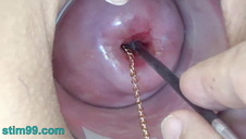 zajęła się obiema pałami